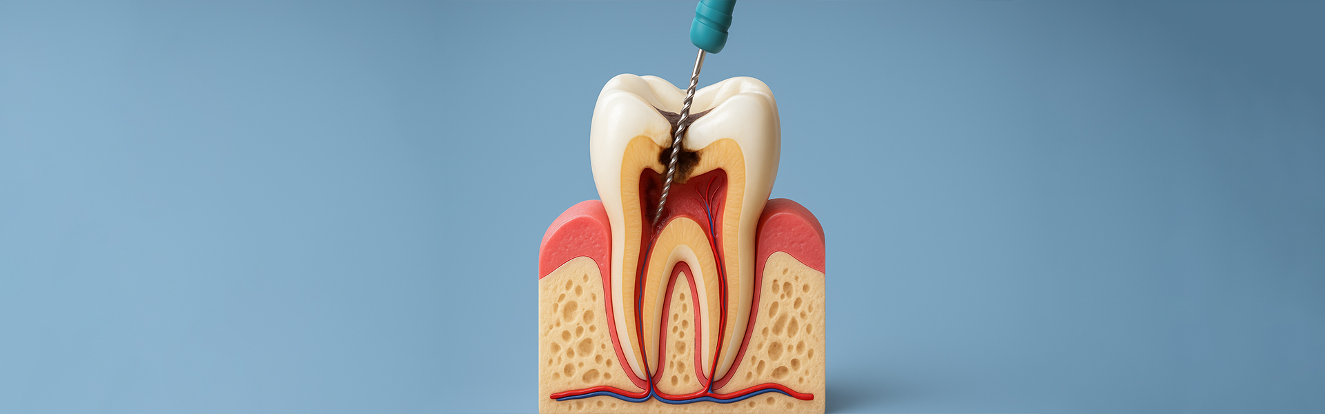 How to Avoid Root Canal Pain with Advanced Endodontic Care